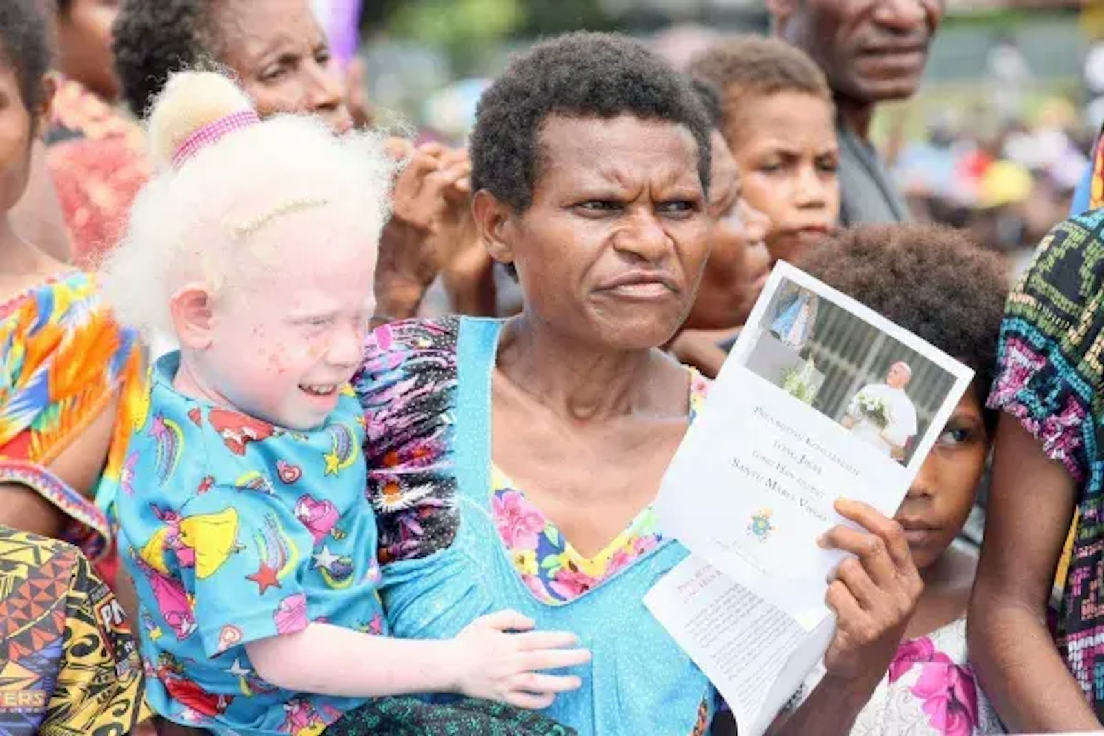 Una mujer con un niño albino asiste al encuentro con el Papa Francisco en Vanimo, Papúa Nueva Guinea. Crédito: Daniel Ibáñez / EWTN News.